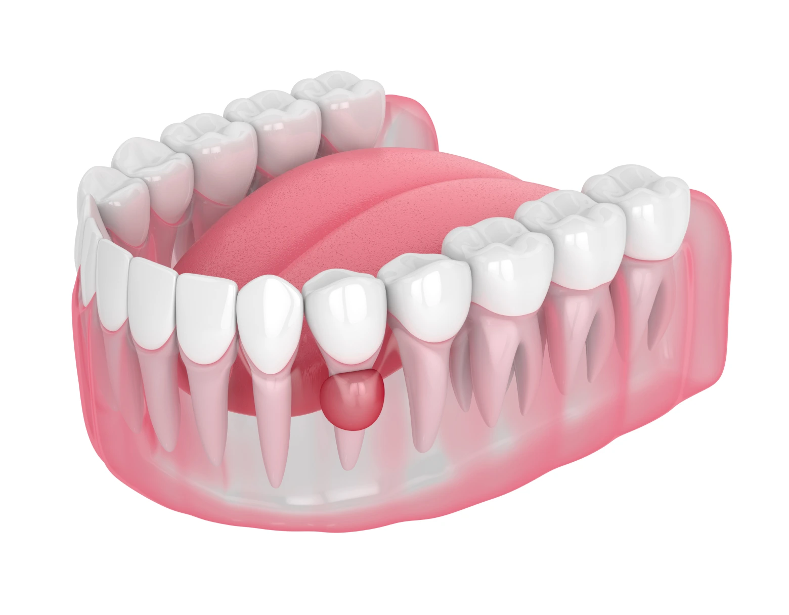 periodoncia 1